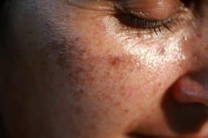 Crème Solaire - article de blog - radiations - UV - explications - Secrets de Miel
